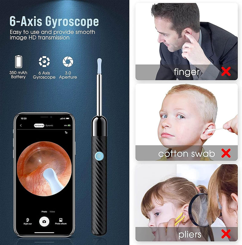 Earwax Remover Tool with 8 Pcs Ear Set - with Camera